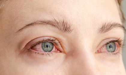 Bayramda Şeker Göze Vuruyor