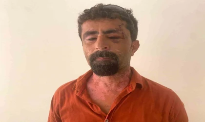 Antalya’da öfkeli damat kayınpederini hastanelik etti